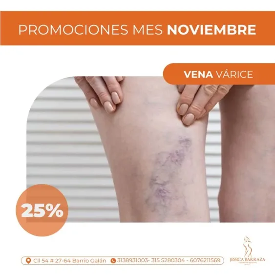 Centro de Estetica Jessica Barraza_Promo Noviembre (8)